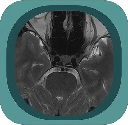 mri cavernous sinus anatomy icon